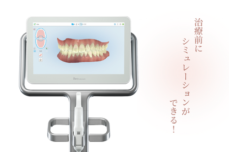 インビザラインのイメージ