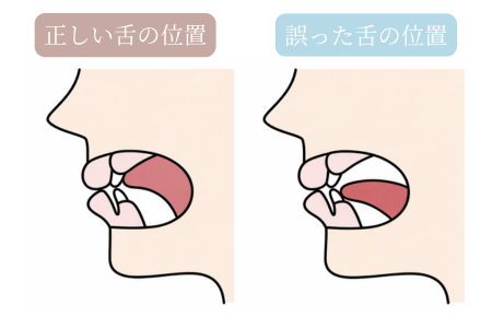 習慣と筋肉のバランス（舌・唇・頬）